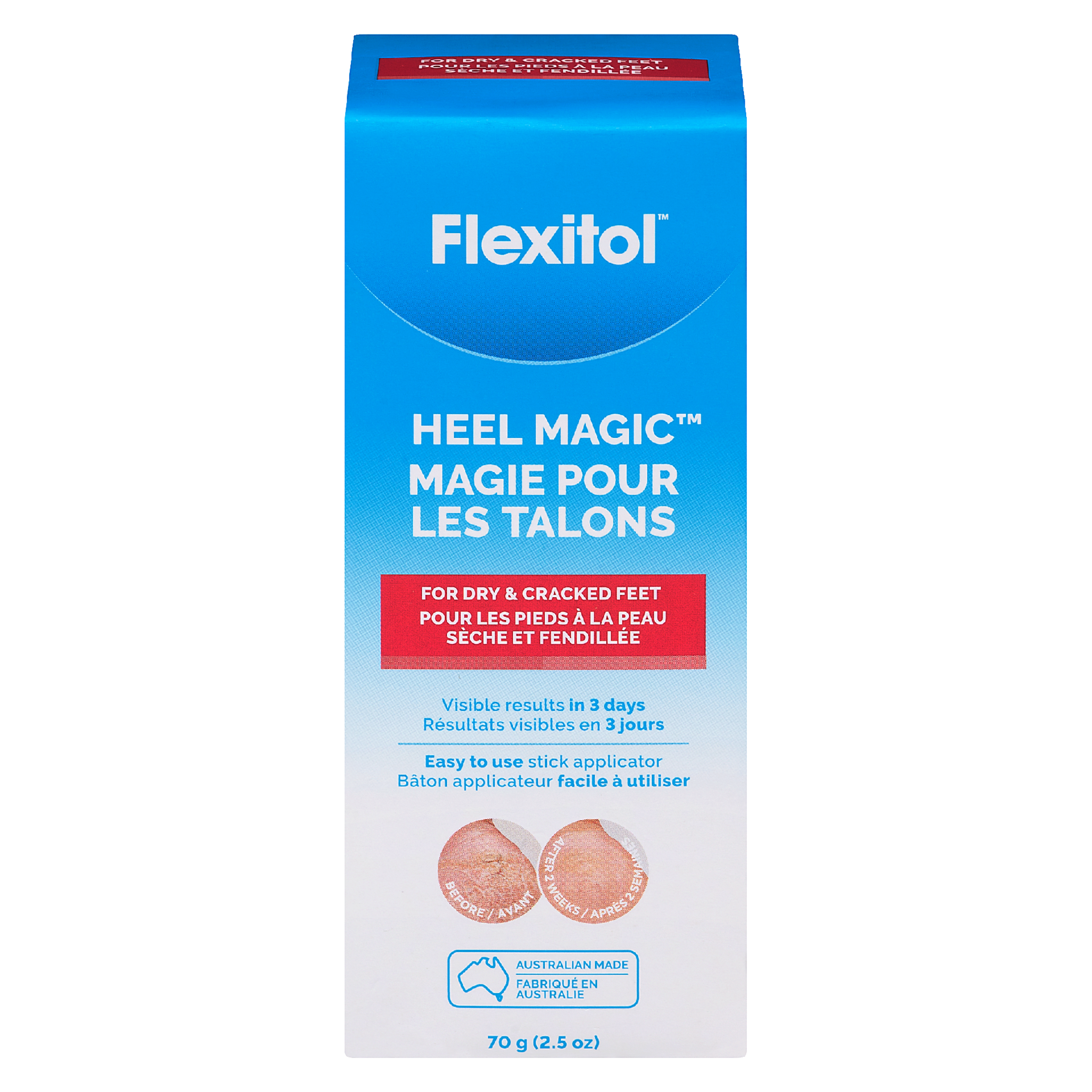 Flexitol Heel Magic 70 g