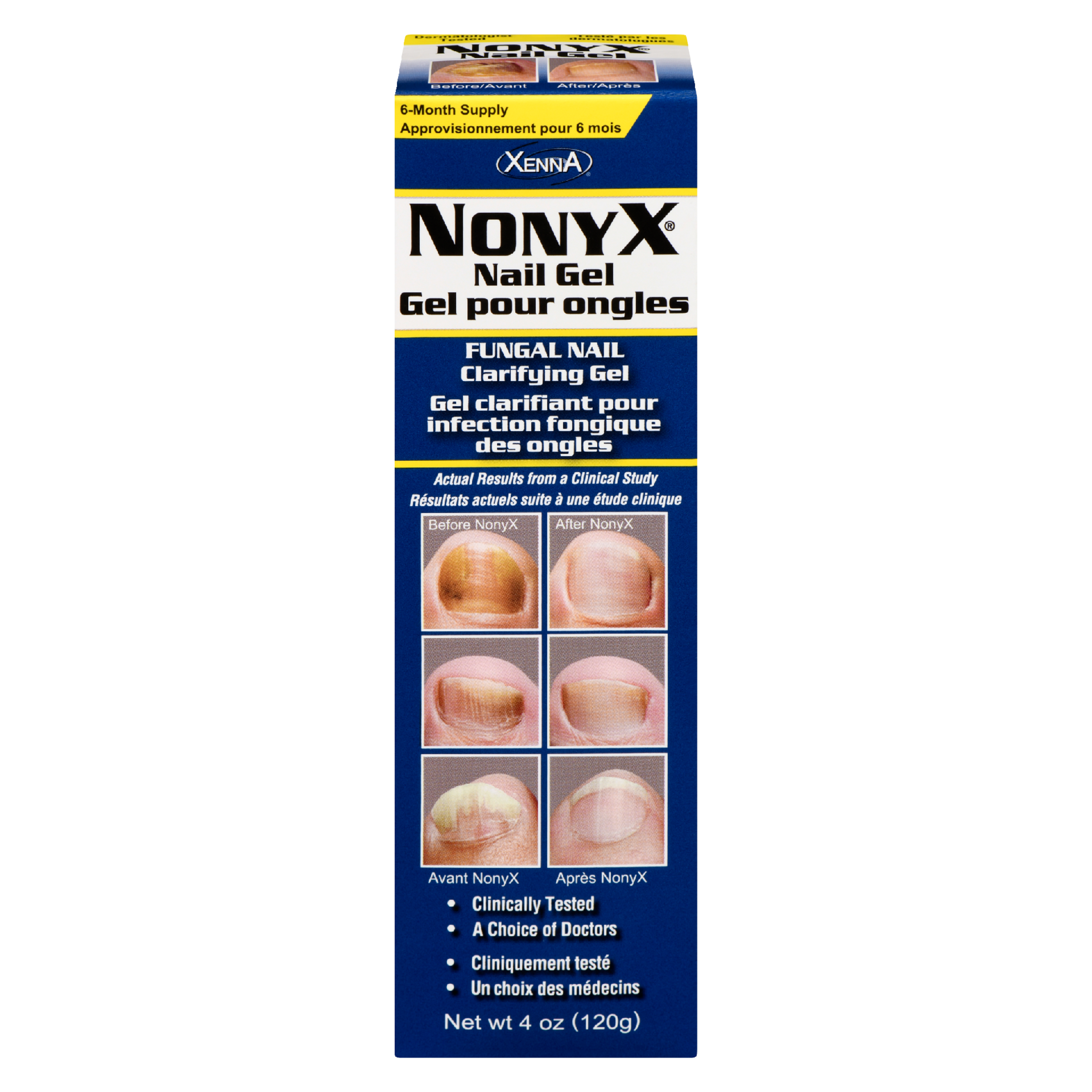 NONYX Fungal Nail Clarifying Gel 120 g
